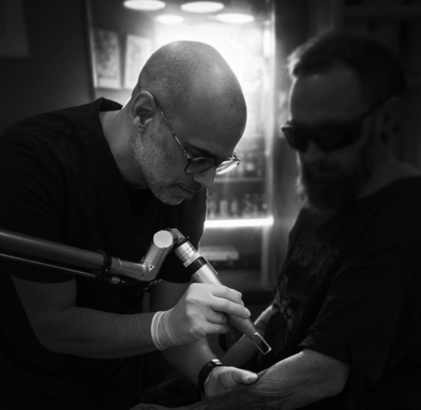 Servicio de eliminación de tatuajes con láser en Lugo — Camaleon Tattoo