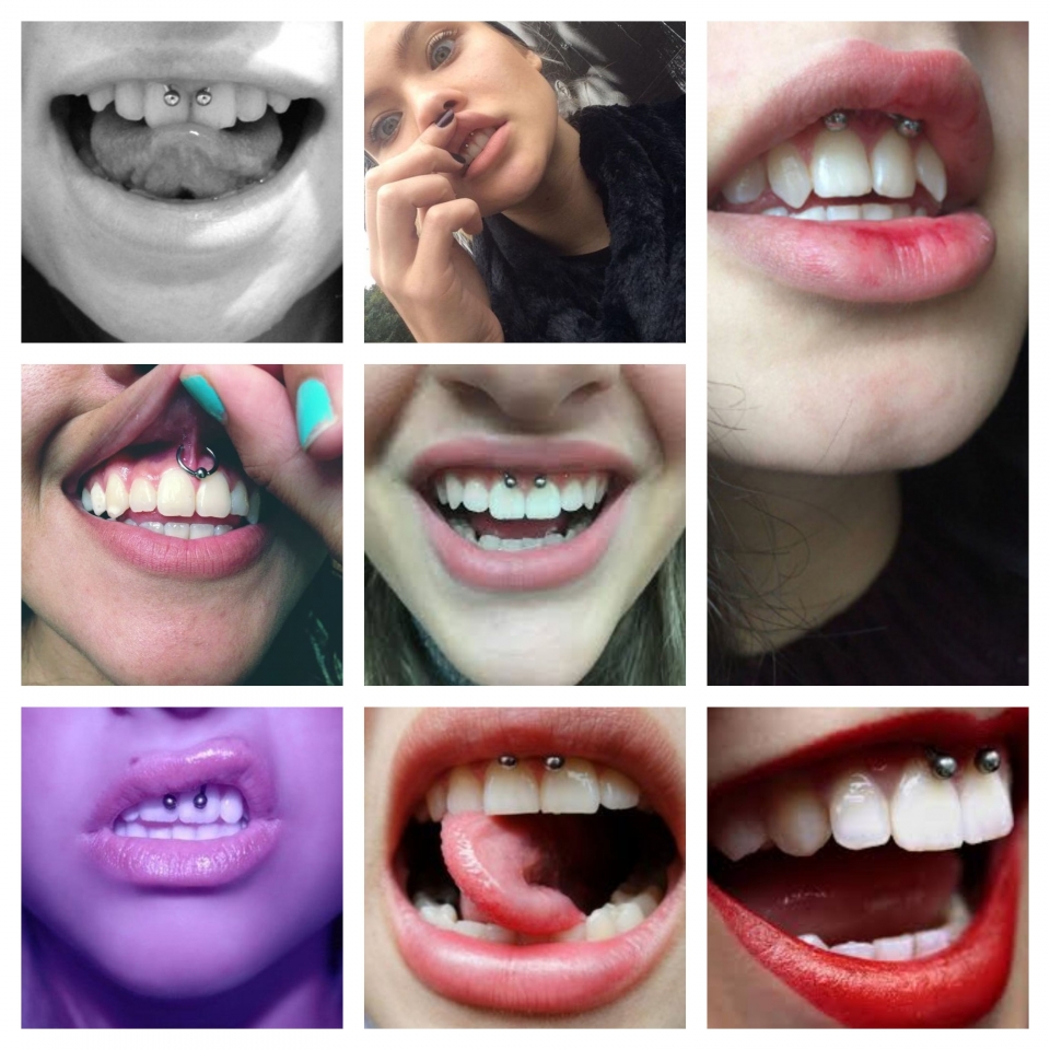 Ejemplos de Gum Piercing