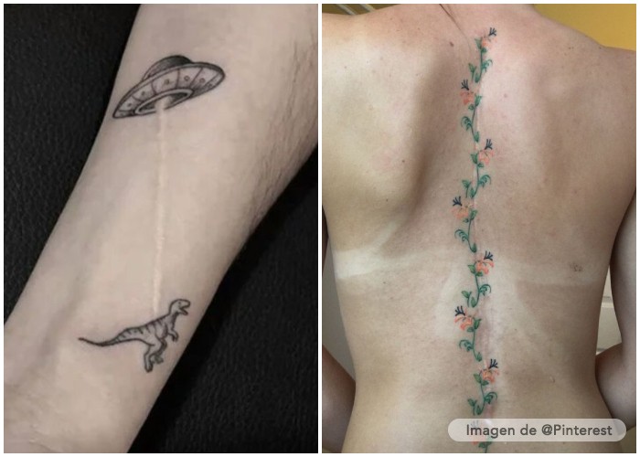 tatuajes con cicatrices y heridas