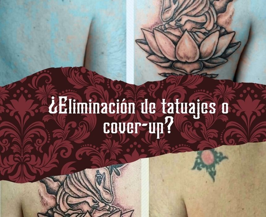 Eliminación de tatuajes y cover-up: segundas oportunidades para tu piel